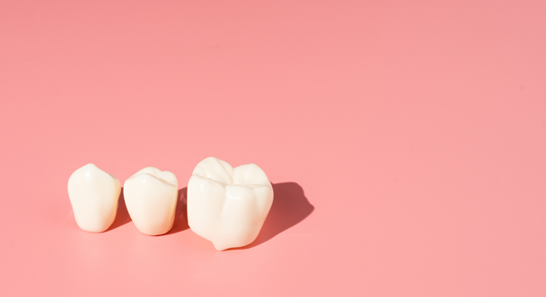 How Dental Crowns Are Used With Dental Fillings